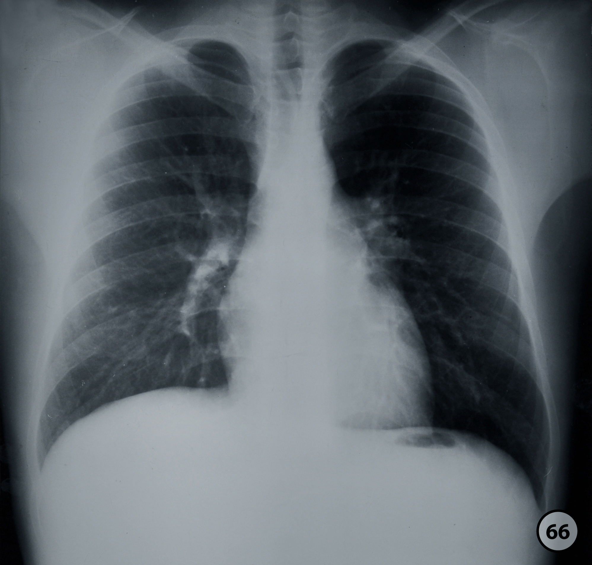 Thorax Frontal AnatomyTOOL